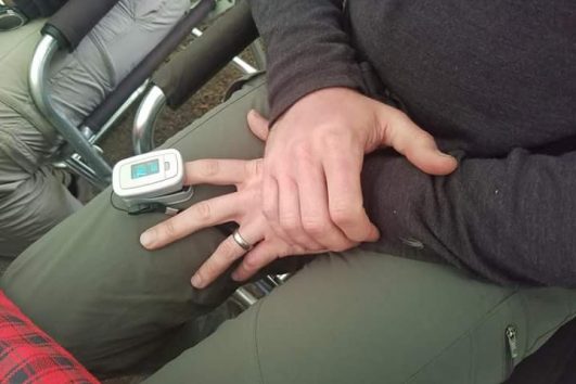 Finger pulse oximeter